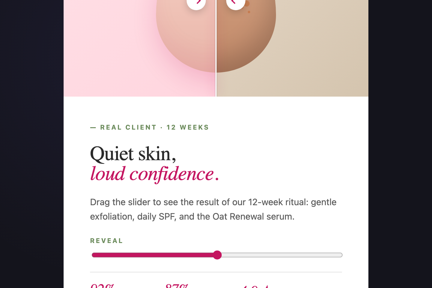 Before/After Slider — preview